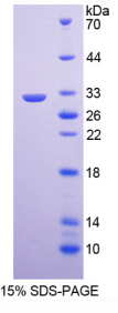 Ⅳ型胶原α5(COL4α5)重组蛋白