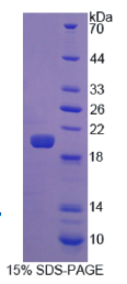成纤维细胞生长因子22(FGF22)重组蛋白