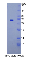 侧支发芽因子同源物2(SPRY2)重组蛋白