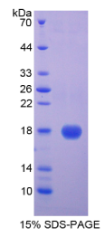 半胱氨酸蛋白酶抑制剂5(CST5)重组蛋白