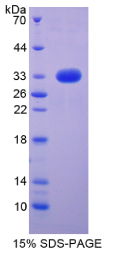 Notch同源物4(NOTCH4)重组蛋白