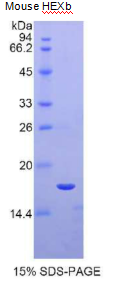 氨基己糖苷酶Bβ(HEXβ)重组蛋白