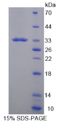 CD19分子(CD19)重组蛋白