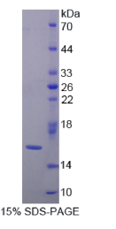 半乳糖凝集素9B(GAL9B)重组蛋白