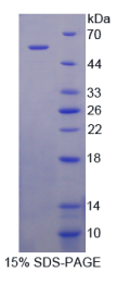 P-选择素糖蛋白配体1(PSGL1)重组蛋白