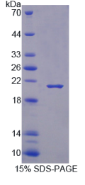 RNA结合基元蛋白3(RBM3)重组蛋白