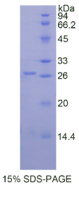 蛋白酶3(PR3)重组蛋白