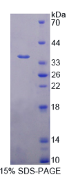 蛋白酶激活亚基3(PSME3)重组蛋白