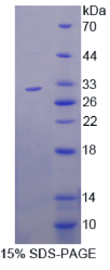 ATP结合盒转运蛋白C2(ABCC2)重组蛋白