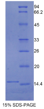 白介素13受体α2(IL13Rα2)重组蛋白