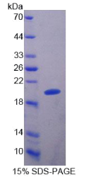 Slit同源物2(Slit2)重组蛋白