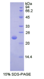 α-胞衬蛋白(SPTAN1)重组蛋白