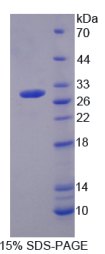 棕榈酰化膜蛋白2(MPP2)重组蛋白