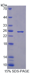 自然杀伤细胞受体2B4(NKR2B4)重组蛋白