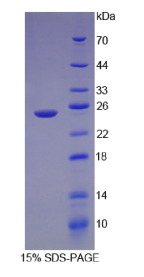 层粘连蛋白α1(LAMα1)重组蛋白