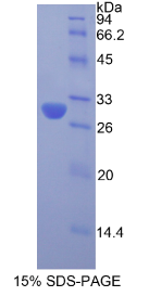 顶体蛋白(ACR)重组蛋白