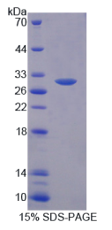 ATP结合盒转运蛋白C10(ABCC10)重组蛋白