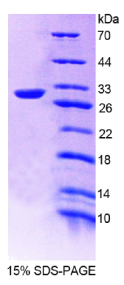 肿瘤关联钙信号转导子2(TACSTD2)重组蛋白