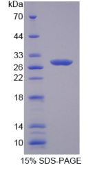 半胱氨酸丰富分泌蛋白2(CRISP2)重组蛋白