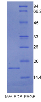 半胱氨酸蛋白酶抑制剂3(CST3)重组蛋白