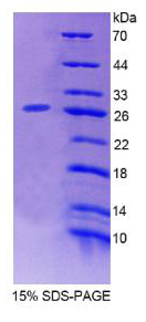 蛋白激酶D2(PKD2)重组蛋白