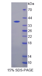 半乳糖凝集素12(GAL12)重组蛋白