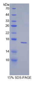 保护素(CD59)重组蛋白