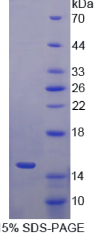 S100钙结合蛋白A15(S100A15)重组蛋白