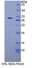 CD1d分子(CD1d)重组蛋白