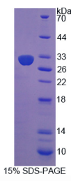 Ⅸ型胶原α1(COL9α1)重组蛋白