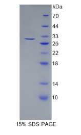 层粘连蛋白β3(LAMβ3)重组蛋白