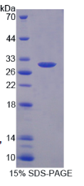 L-型电压依赖钙离子通道α1S亚基(CACNα1S)重组蛋白