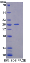 白介素17D(IL17D)重组蛋白