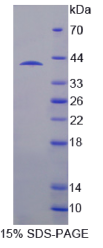 SH3域结合蛋白2(SH3BP2)重组蛋白