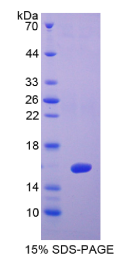 半乳糖凝集素1(GAL1)重组蛋白