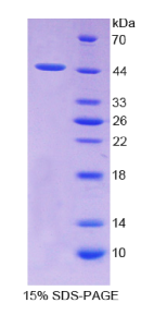 转化生长因子β1(TGFβ1)重组蛋白