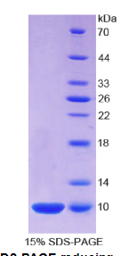 S100钙结合蛋白A7(S100A7)重组蛋白