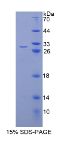 真核翻译延伸因子1α1(EEF1α1)重组蛋白