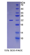 层粘连蛋白α1(LAMα1)重组蛋白