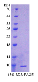T-激肽原1(KNT1)重组蛋白