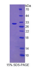 蛋白酶体亚基α1(PSMα1)重组蛋白