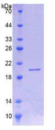 白介素18结合蛋白(IL18BP)重组蛋白