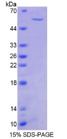 蛋白酪氨酸激酶2β(PTK2β)重组蛋白