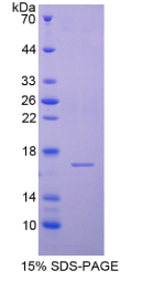 半胱氨酸蛋白酶抑制剂6(CST6)重组蛋白