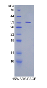 彩斑4-20同源物1抑制因子2(SUV420H2)重组蛋白