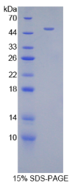 Dickkopf相关蛋白4(DKK4)重组蛋白