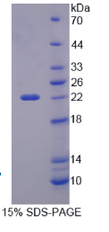 PHD指蛋白8(PHF8)重组蛋白