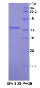 周期素依赖性激酶4(CDK4)重组蛋白