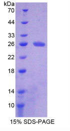 Ⅵ型胶原α3(COL6α3)重组蛋白