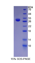 Split多毛增强子1(HES1)重组蛋白